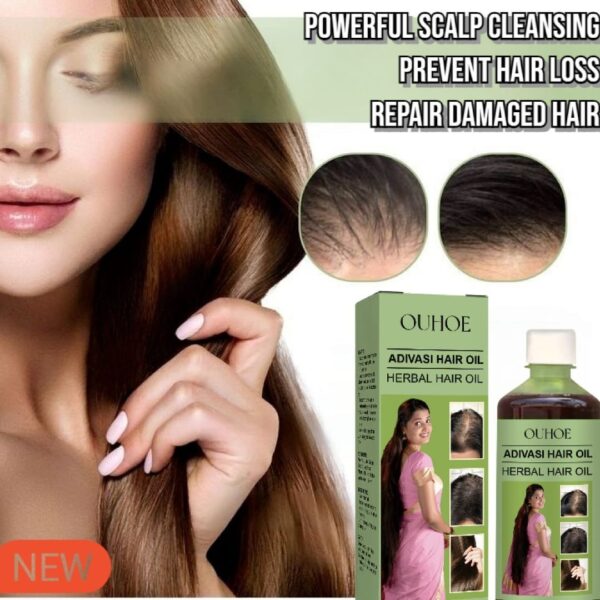 OUHOE Adivasi Hair Oil Herbal hair care for scalp cleansing hair loss prevention, and damage repair - Image 2