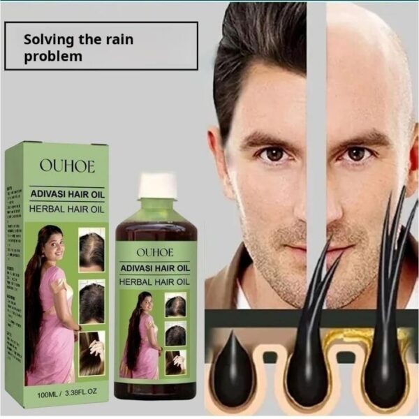 OUHOE Adivasi Hair Oil Herbal hair care for scalp cleansing hair loss prevention, and damage repair - Image 4