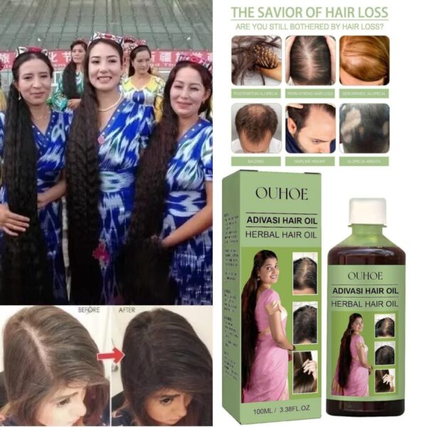 OUHOE Adivasi Hair Oil Herbal hair care for scalp cleansing hair loss prevention, and damage repair - Image 5