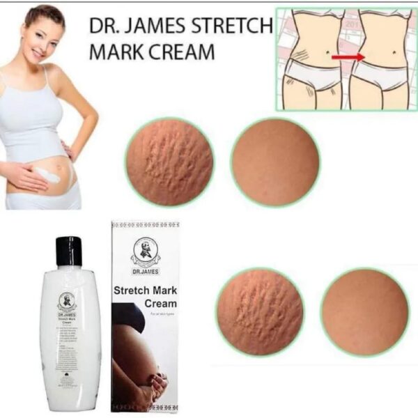 Dr. James Stretch Mark Cream - Image 2